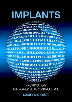 Daniel Marques - Implants