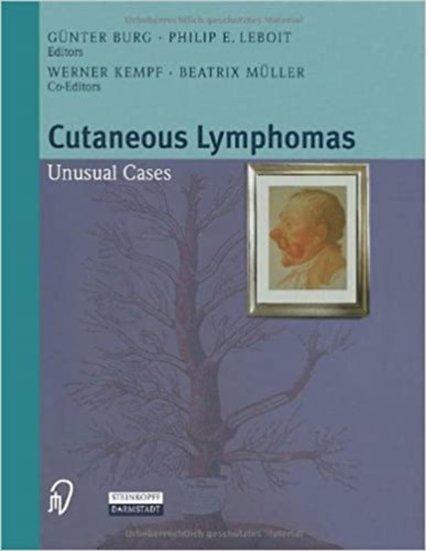Philip E. Leboit, Werner Kempf, Beatrix Müller Günter Burg - Cutaneous Lymphomas - Unusual Cases