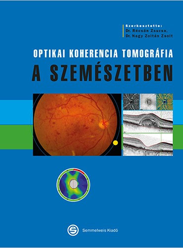 R�cs�n Zsuzsanna Nagy Zolt�n Zsolt dr. - Optikai koherencia tomogr�fia a szem�szetben