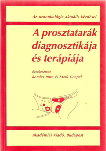 Romics Imre; Mark Goepel - A prosztatarák diagnosztikája és terápiája