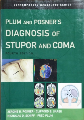 Jerome B. Posner - Clifford B. Saper - Nicholas D. Schiff - Fred Plum - Plum and Posner's Diagnosis of Stupor and Coma (4th edition)