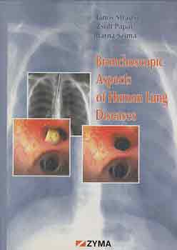 Strausz-Ppai-Szima - Bronchoscopic Aspects of the Human Lung Diseases