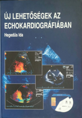 Hegedűs Ida - Új lehetőségek az echokardiográfiában