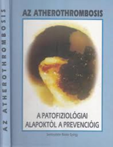 Dr. Blaskó György - Az atherothrombosis a patofiziológiai alapoktól a prevencióig