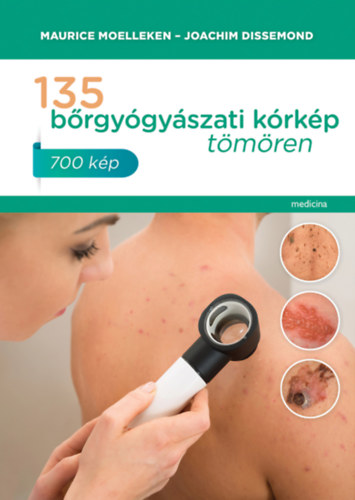 Maurice Moelleken   Joachim Dissemond - 135 brgygyszati krkp tmren - 700 kp