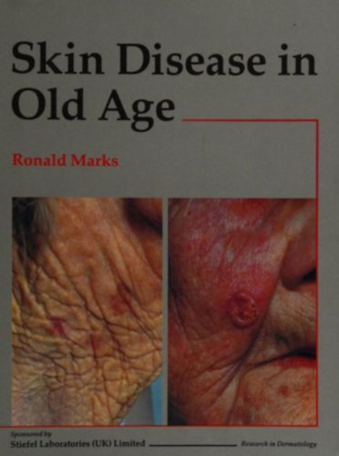 Ronald Marks - Skin Disease in Old Age