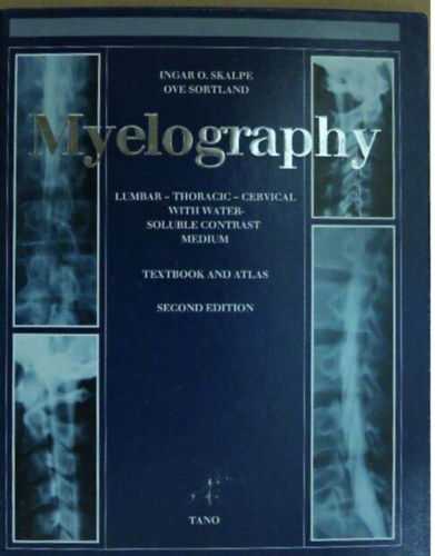 Ingar O. Skalpe Ove Sortland - Myelography Lumbar - Thoracic - Cervical With Water-Soluble Contrast Medium - Textbook and Atlas