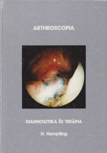 H. Hempfling - Arthroscopia - Diagnosztika s terpia
