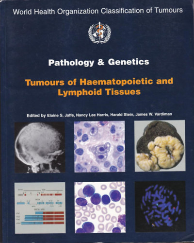 Pathology and Genetics of Tumours of Haematopoietic and Lymphoid Tissues (World Health Organization Classification of Tumours)