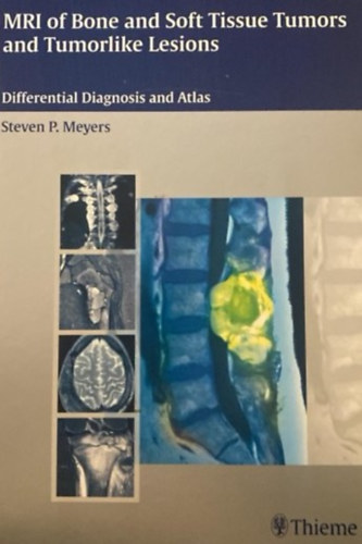 MRI of Bone and Soft Tissue Tumor and Tumorlike Lesions
