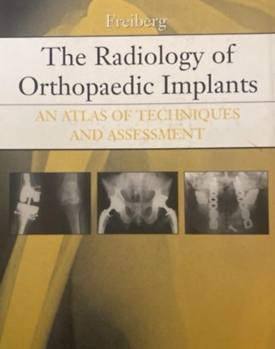 The Radiology Orthopaedic Implants an Atlas of Techniques and Assessment