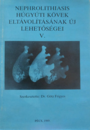Dr. G�tz Frigyes - Nephrolithiasis H�gy�ti k�vek elt�vol�t�s�nak �j lehet�s�gei V.