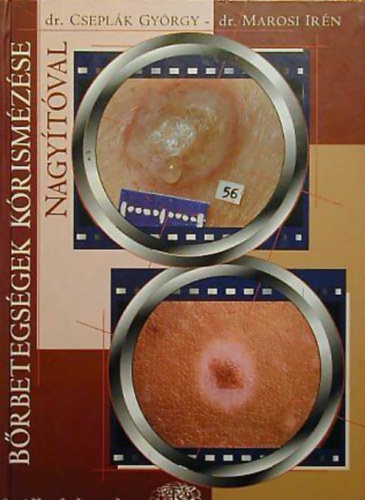 Dr. Csepl�k Gy�rgy Marosi Ir�n - B�rbetegs�gek k�rism�z�se nagy�t�val