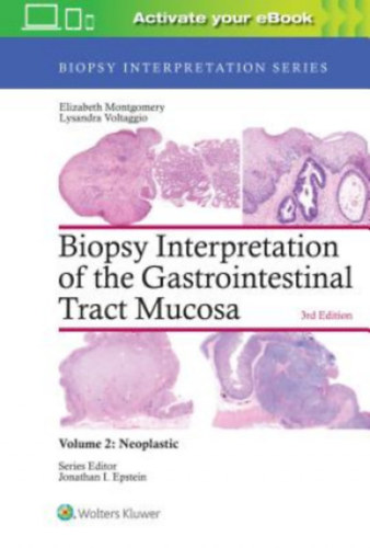 Lysandra Voltaggio Elizabeth A. Montgomery - Biopsy Interpretation of the Gastrointestinal Tract Mucosa Volume 2 - Neoplastic: Print + eBook with Multimedia
