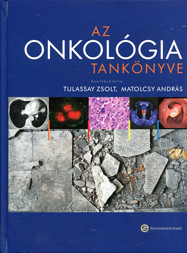 Tulassay Zsolt - Matolcsy Andr�s szerk - Az onkol�gia tank�nyve