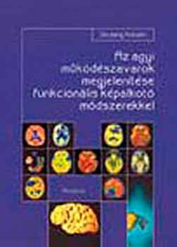 Borb�ly Katalin - Az agyi m�k�d�szavarok megjelen�t�se funkcion�lis k�palkot� m�dszer...