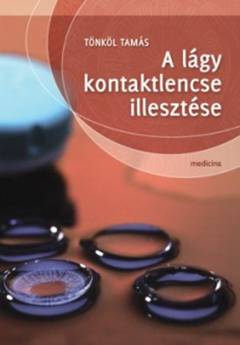 Dr. Tönköl Tamás - A lágy kontaktlencse illesztése