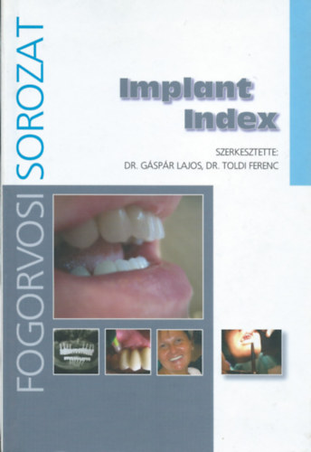 Dr. G�sp�r Lajos - Dr. Toldi Ferenc - Implant Index (Fogorvosi sorozat)