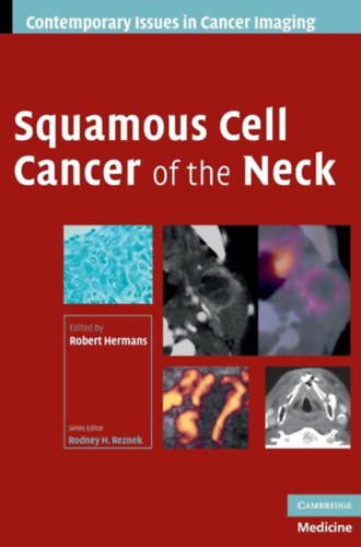 Robert Hermans, Rodney H. Reznek - Squamous Cell Cancer of the Neck (Contemporary Issues in Cancer Imaging)