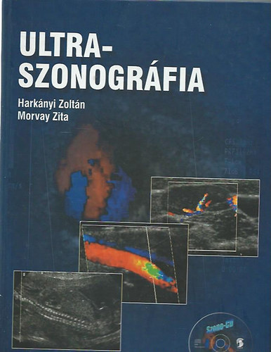 Hark�nyi Zolt�n; Morvay Zita  (szerk.) - Ultraszonogr�fia