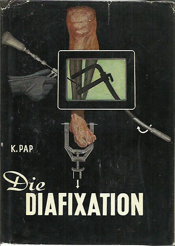 dr. Papp Kroly, Kldor Gyrgy - Die Diafixation - Ein Verfahren zur Versorgung schwer einrichtbarer u. zu Verschiebung neigender Schaftbruche