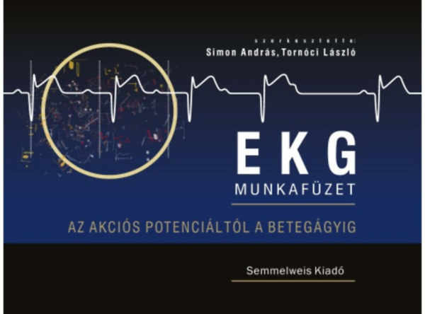 Tornóczi László Simon András - EKG érthetően. Az akciós potenciáltól a betegágyig