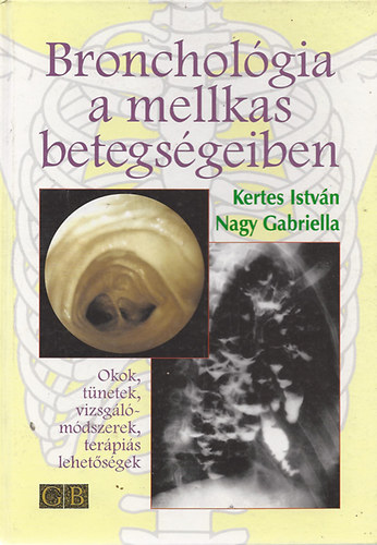 Kertes Istv�n; Nagy Gabriella - Bronchol�gia a mellkas betegs�geiben