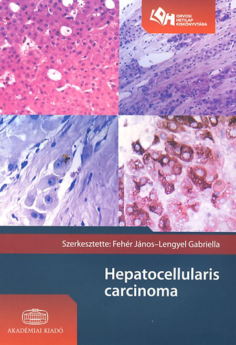 Fehér János; Lengyel Gabriella - Hepatocellularis carcinoma