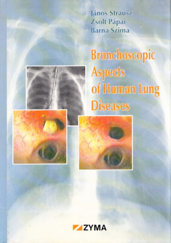 Strausz-Ppai-Szima - Bronchoscopic Aspects of Human Lung Diseases