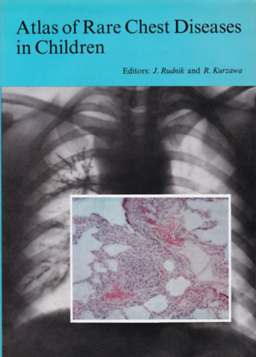 Rudnik - Kurzawa - Atlas of Rare Chest Diseases in Children (Ritka gyermek-tdmegbetegedsek atlasza - angol nyelv)