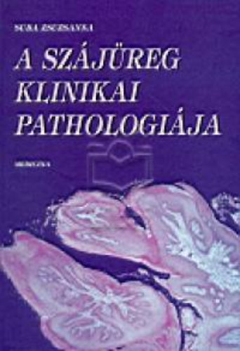 Suba Zsuzsanna - A szjreg klinikai pathologija