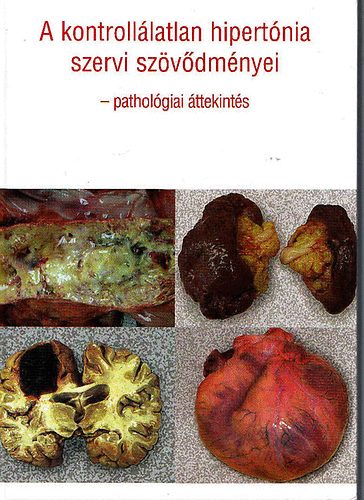 Dr. Spos Gbor; Dr. Habony Norbet - A kontrolllatlan hipertnia szervi szvdmnyei - Patholgiai ttekints