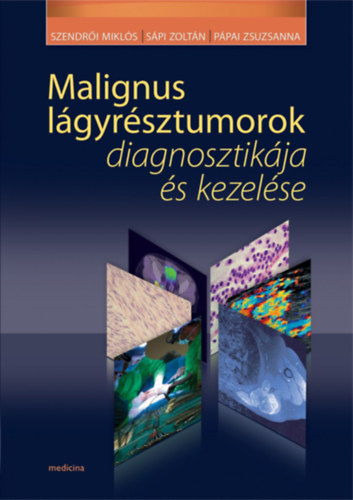 Spi Zoltn, Ppai Zsuzsa  Szendri Mikls (szerkesztk) - Malignus lgyrsztumorok diagnosztikja s kezelse