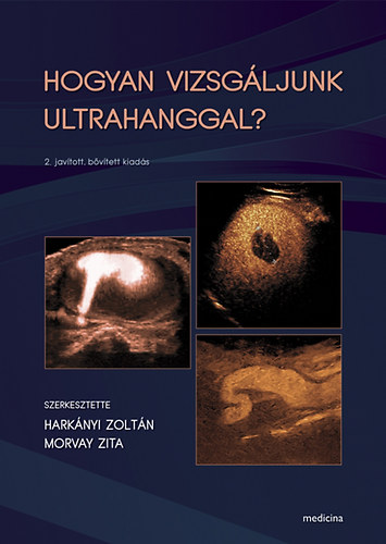 Hogyan vizsg�ljunk ultrahanggal?