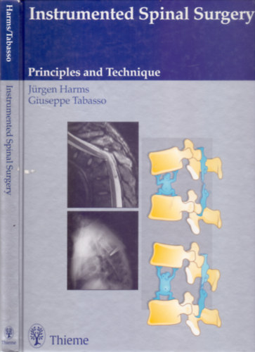 Jürgen Harms M.D. - With the collaboration of Rocco Cinanni M.D. Giuseppe Tabasso M.D. - Instrumented Spinal Surgery - Principles and Technique (503 illustrations)