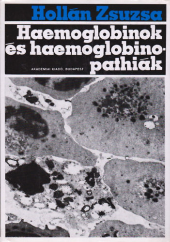 Holl�n Zsuzsa - Haemoglobinok �s Haemoglobinopathi�k