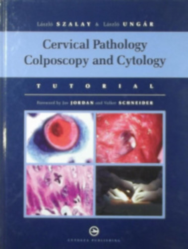 Ungr Lszl Szalay Lszl - Cervical Pathology Colposcopy and Cytology - Mhnyak patolgia Kolposzkpia s citolgia