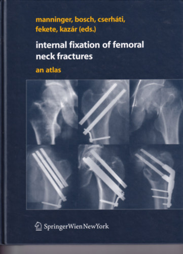 Pter Cserhti, Kroly Fekete, Gyrgy Kazr Jen Manninger - Internal Fixation of Femoral Neck Fractures